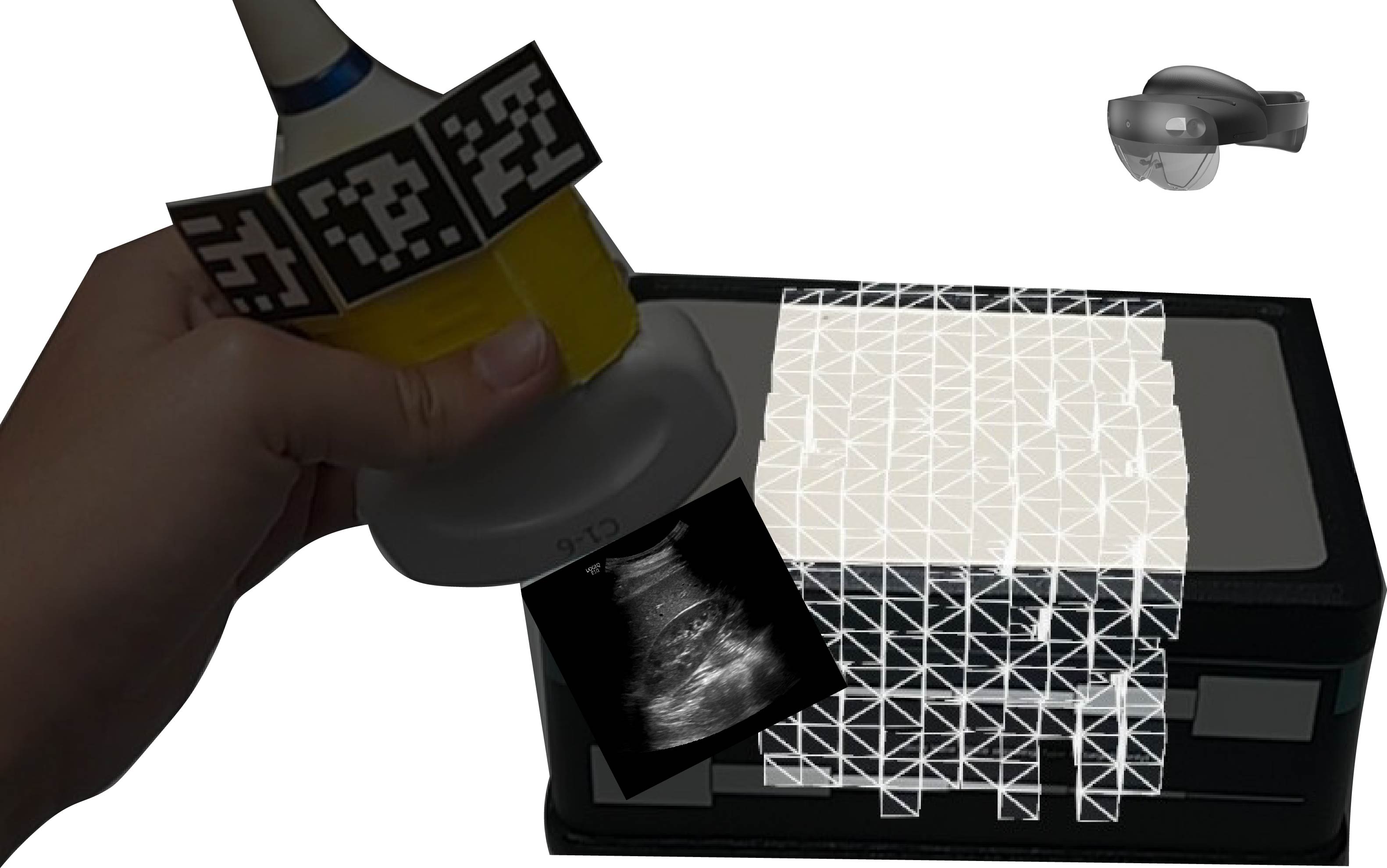 An augmented reality image of an ultrasound